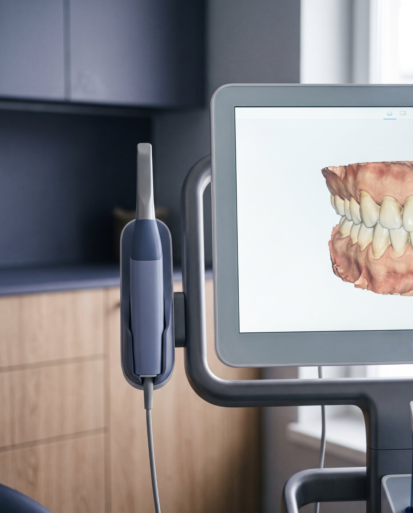 Digital intraoral scanner in use